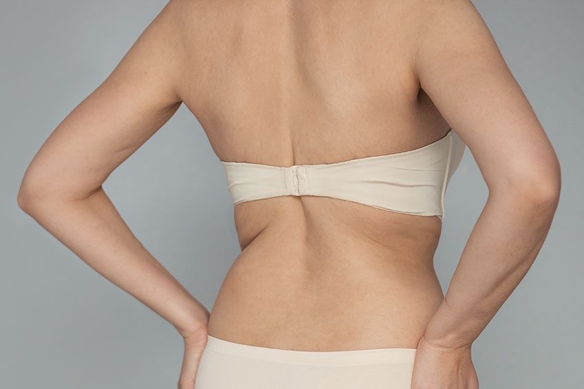 Bra Fat (Bra Bulge) - Underlying Causes & Removal