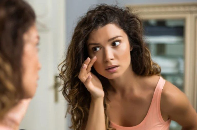 how to get rid of eye bags without surgery