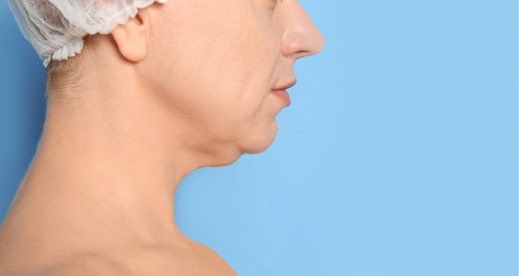 Different Types Of Double Chin Removal In Singapore