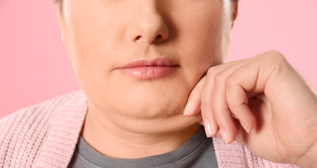 Different Types Of Double Chin Removal In Singapore