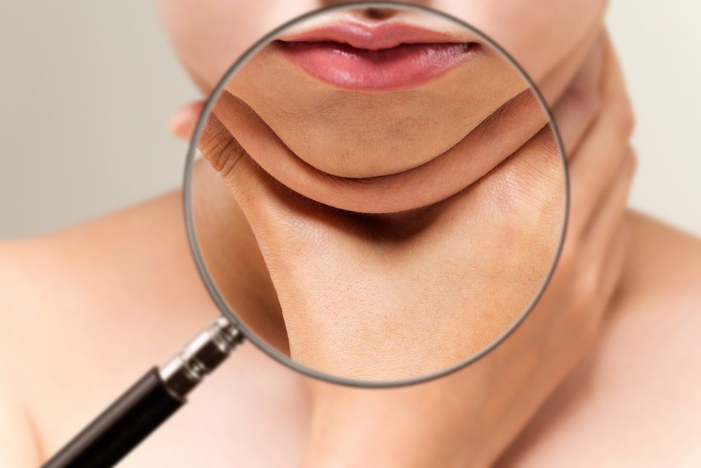 double chin removal singapore