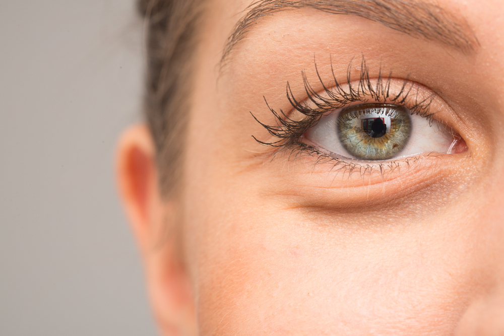 Non-Surgical Eye Bag Removal