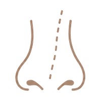 Minor Nasal Asymmetry