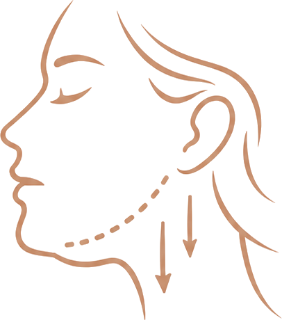 Facial Sagging