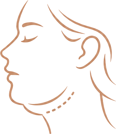 Under-Chin Fullness